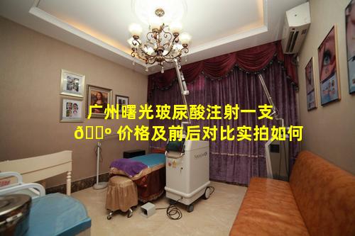 广州曙光玻尿酸注射一支 🐺 价格及前后对比实拍如何